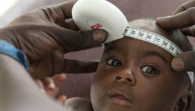 Brain imaging tool seeks signs of infant malnutrition