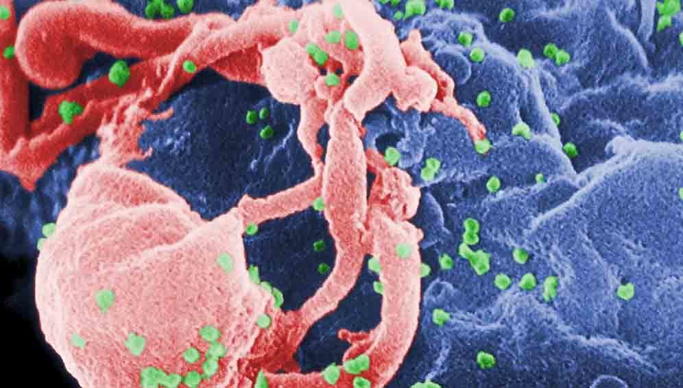 HIV AIDS Virus - Main