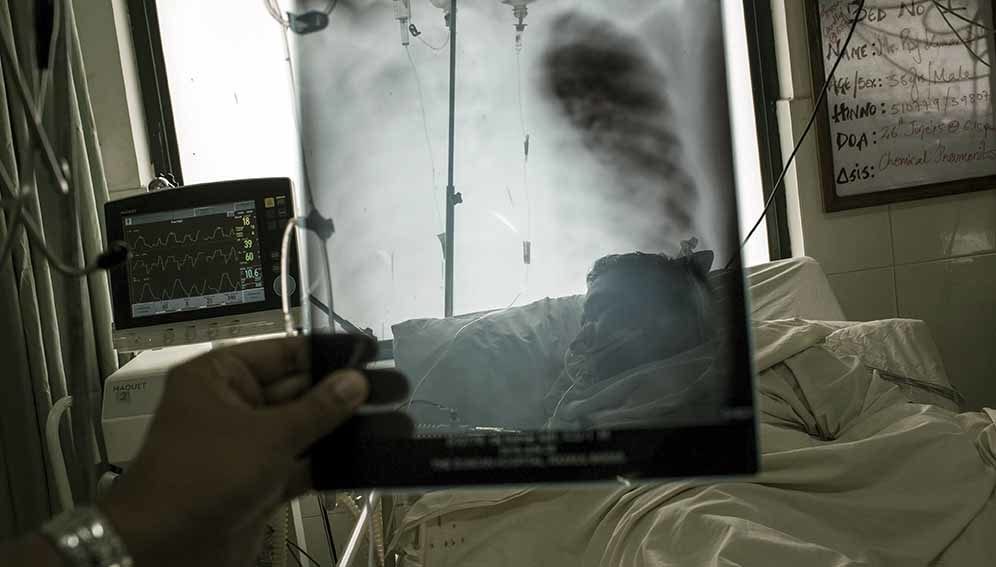 Lungs and Walls - Main