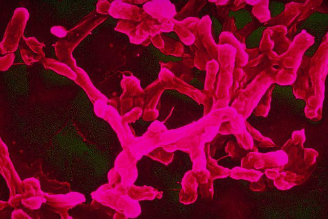 typhoid
