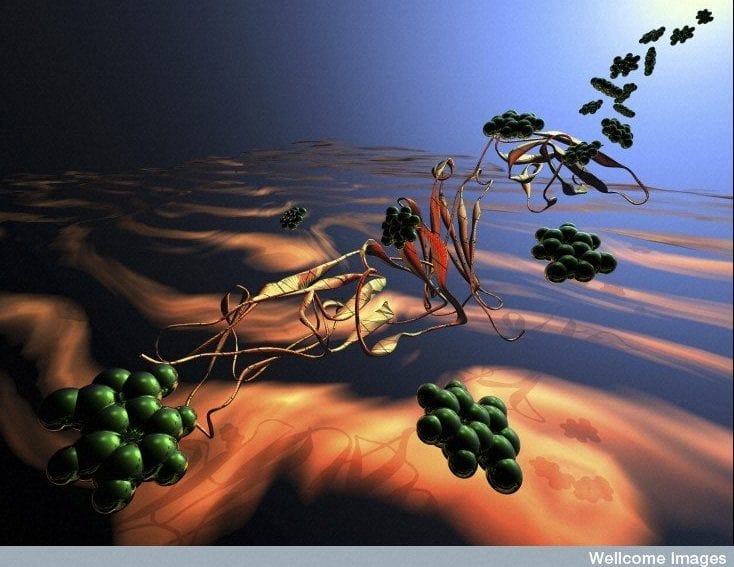 Immunoglobulin disease