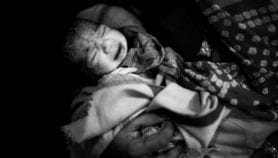 Focus on Disability: Monitor birth defects to save lives