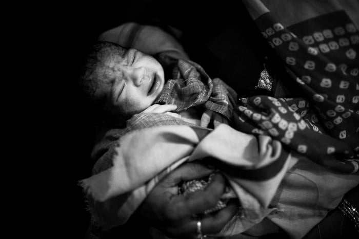 Baby Zika disease.jpg