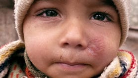 Arab countries caught in a cycle of war and disease