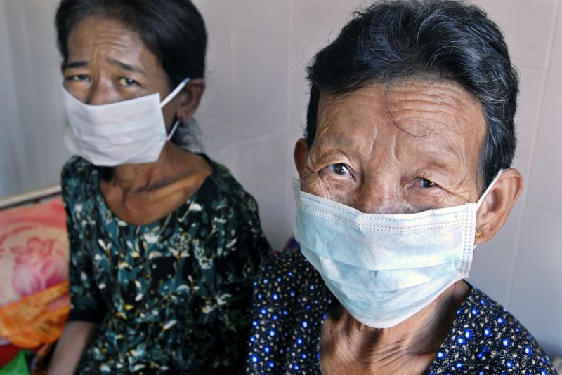HIV positive and has tuberculosis (TB)