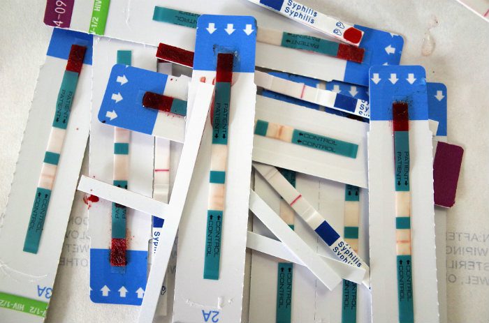 HIV tests.jpg