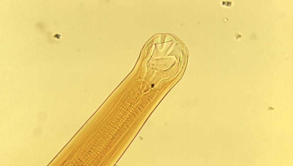 Hookworm_CDC website.jpg