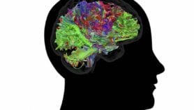 Transistor that mimics neurons developed