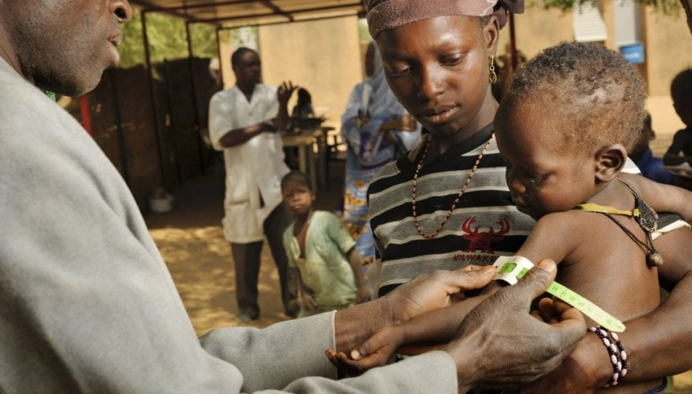 screening for malnutrition
