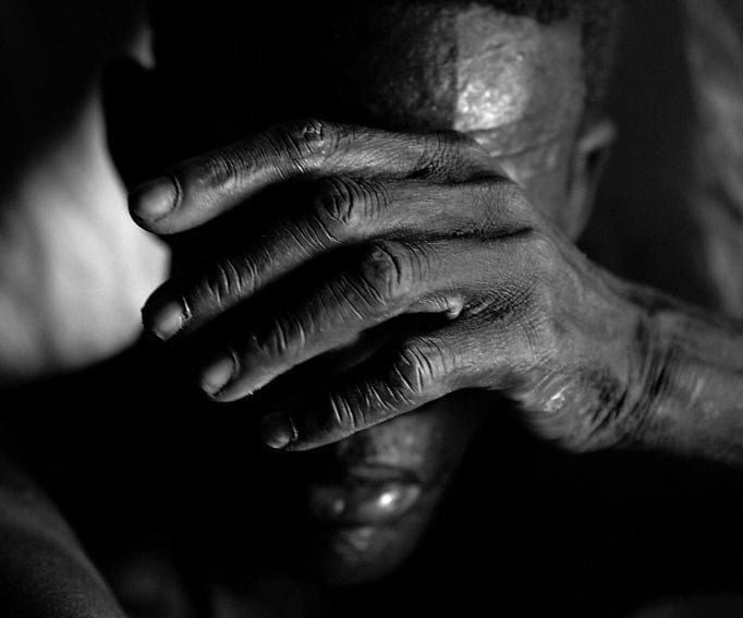 Man suffering from Kala Azar