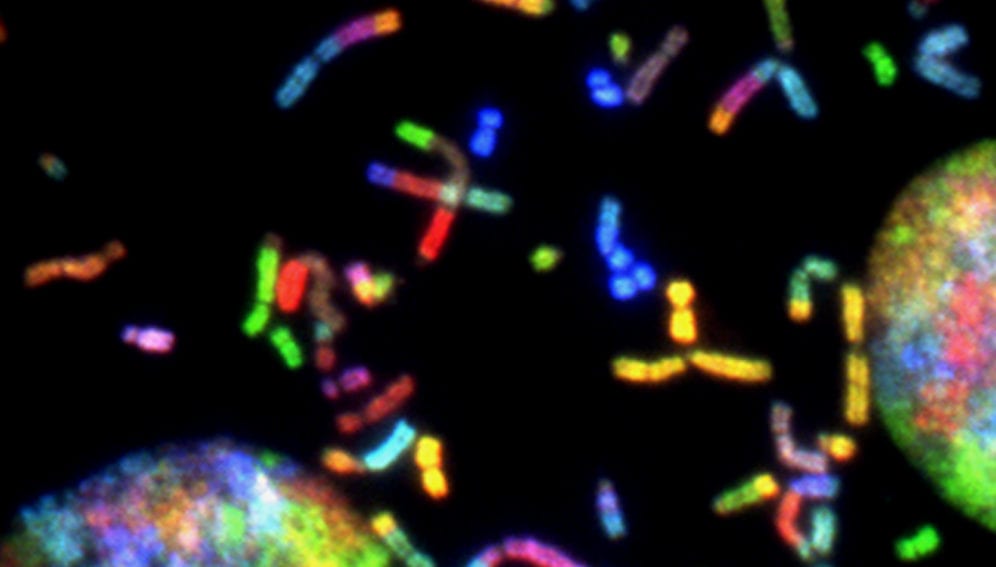 Brain Cancer Chromosome