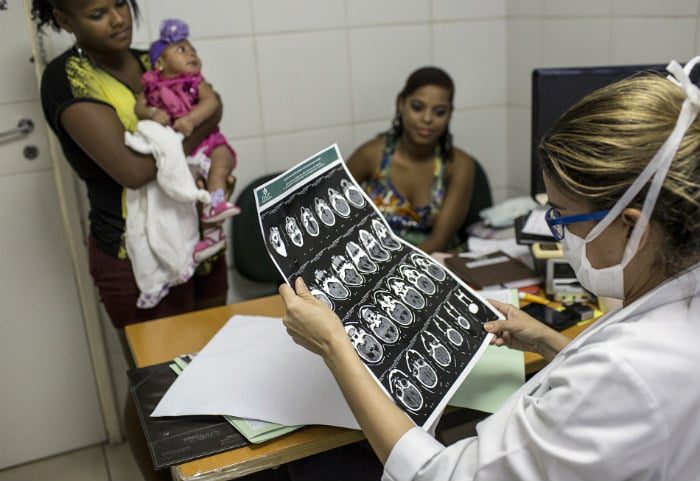 Zika encephalitis scan.jpg