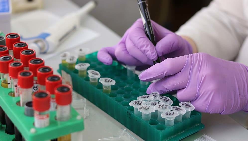 Vaccine research