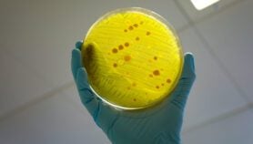 Drug resistance worsens UTI crisis in Malawi