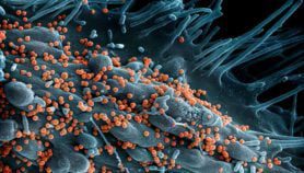 Hidden Lassa fever cases spur vaccination plans