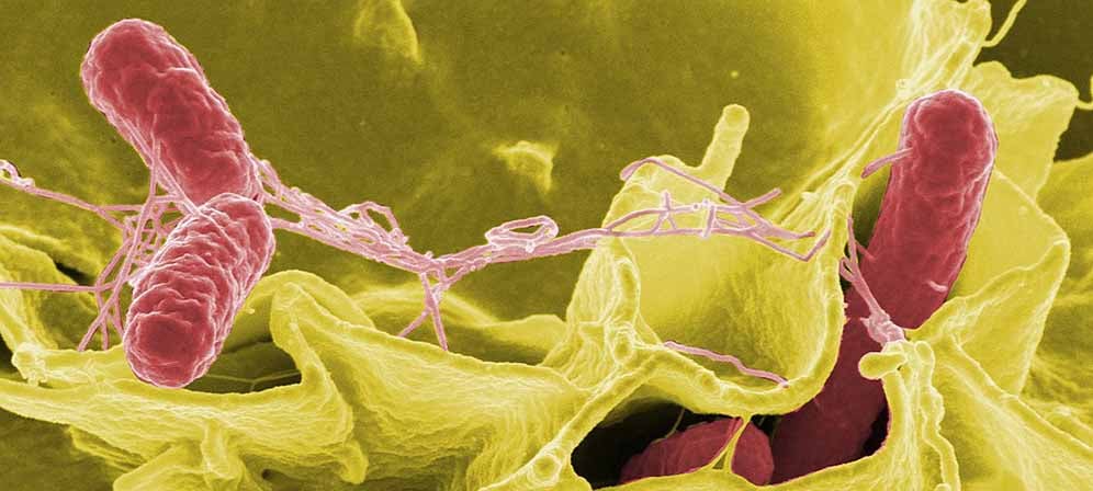 Color-enhanced scanning electron micrograph showing Salmonella Typhimurium (red) invading cultured human cells. A study in north-eastern Uganda has shown that nearly half the food and water in the region is contaminated with drug-resistant Salmonella.