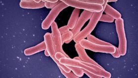 Breakthroughs hailed in childhood TB prevention
