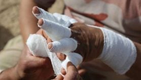 Evidence missing to address burn death disparities