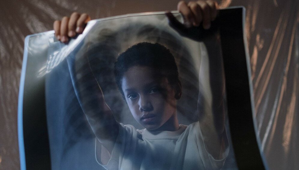 child_xrayflim