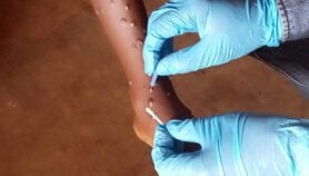 Mpox vaccine rollout to begin in Nigeria, DRC