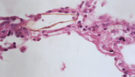 Last-mile surveillance can end neglected diseases—study