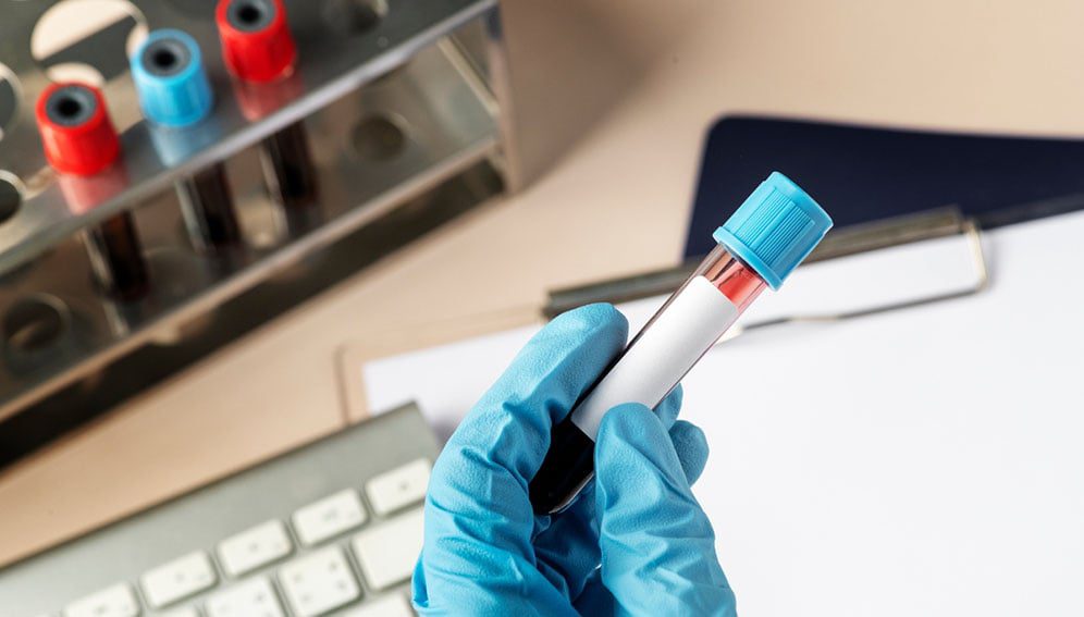 Image by RawPixel.com (Source: https://www.rawpixel.com/image/2300718/free-photo-image-chemistry-blood-collection-laboratory-hospital)