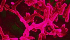 ‘Global response’ needed as typhoid evades antibiotics