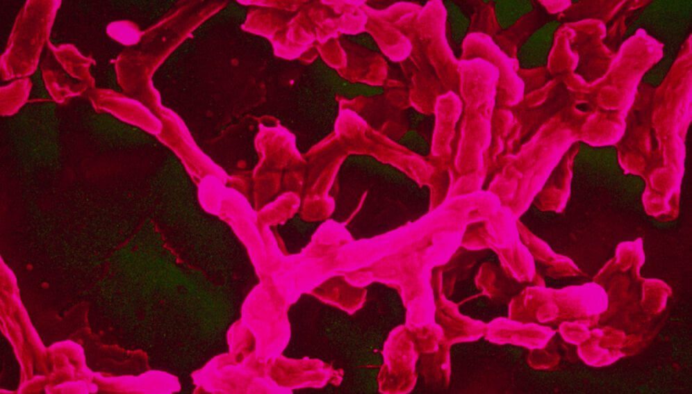 typhoid fever - main